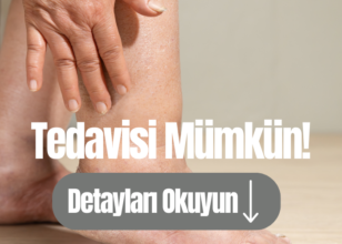 Kalın Bacaklarınızın Sorumlusu Lipödem Olabilir