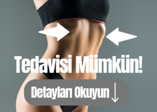 Rib Flare Deformitesine Ağrısız ve İzsiz Çözüm: Ribella Prosedürü ile İnce Bir Bel