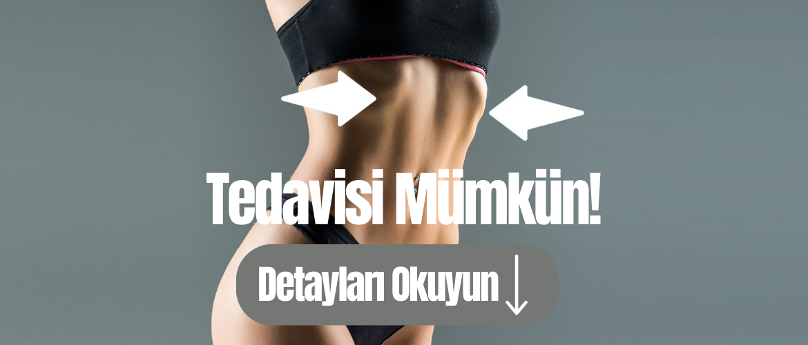 Rib Flare Deformitesine Ağrısız ve İzsiz Çözüm: Ribella Prosedürü ile İnce Bir Bel