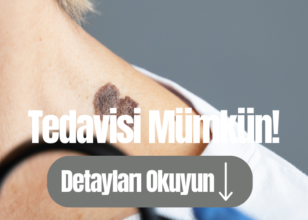 Papillom nedir? Baş Boyun Bölgesinde nerelerde görülür ?