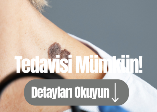 Papillom nedir? Baş Boyun Bölgesinde nerelerde görülür ?