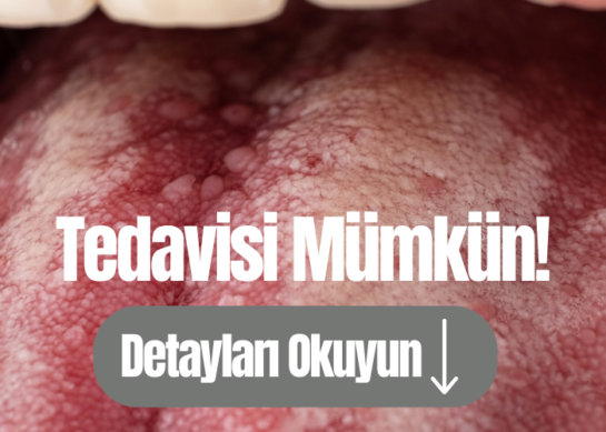 Dil Kanseri Nedir?
